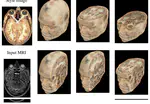 2D to 3D medical image colorization