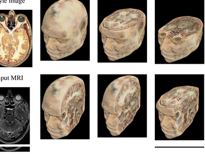 2D to 3D medical image colorization